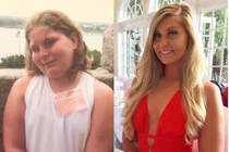 Cô gái giảm cân ngoạn mục nhờ những lời đồn ác ý