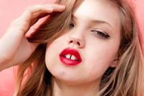 Răng thưa tưởng bình thường, nào ngờ bác sĩ nói nguy hiểm