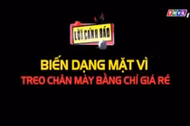 Video: Biến dạng mặt vì treo chân mày bằng chỉ giá rẻ