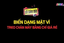 Video: Biến dạng mặt vì treo chân mày bằng chỉ giá rẻ