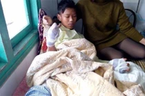 Một thiếu niên mất hai bàn tay vì pháo nổ