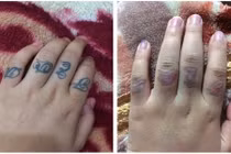 Thiếu nữ xăm hình từ lớp 8 và vết sẹo đi theo cả cuộc đời