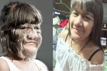 "Cô gái mặt khỉ" cạo sạch lông mặt lộ nhan sắc gây bất ngờ