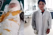 Con ngã hố vôi đang sôi, mẹ tuột da, thịt thò tay kéo con lên