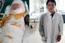 Con ngã hố vôi đang sôi, mẹ tuột da, thịt thò tay kéo con lên