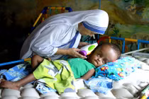 Điều cần biết về căn bệnh khiến đầu trẻ to bất thường