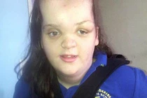 10 thiếu niên mắc chứng bệnh kỳ quặc nhất thế giới