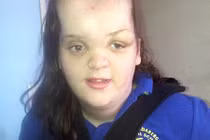 10 thiếu niên mắc chứng bệnh kỳ quặc nhất thế giới