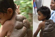 10 ca dị tật kinh dị nhất thế giới