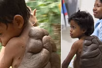 10 ca dị tật kinh dị nhất thế giới