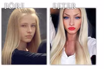 Những trường hợp quái đản do "dao kéo" hỏng