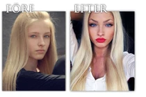 Những trường hợp quái đản do "dao kéo" hỏng