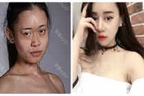 Cô nàng vịt hoá thiên nga nhờ phẫu thuật 