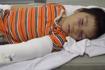 TP HCM: Cha dượng bạo hành bé 6 tuổi gãy tay, chân