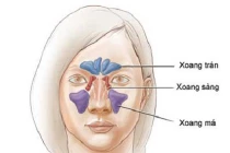 Các loại ung thư đầu cổ thường gặp (1)