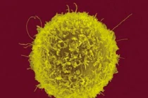 Xem cơ thể chúng ta chiến đấu với ung thư tuyến tụy 