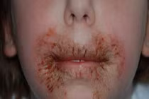 Nên cẩn thận khi dùng khăn giấy ướt cho trẻ