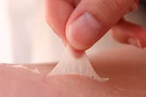 Hình ảnh chứng tỏ bạn bị ung thư da (3)