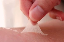 Hình ảnh chứng tỏ bạn bị ung thư da (3)