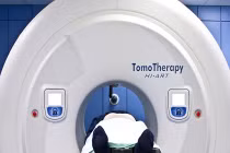 Tác dụng của xạ trị mới với ung thư đầu và cổ