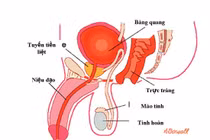 Điều trị ung thư tuyến tiền liệt: lợi bất cập hại