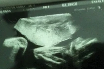 Người mẹ và thai nhi chết do bác sĩ thiếu chuyên nghiệp.