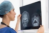 Chi tiết quá trình phẫu thuật hàm dưới trị ung thư