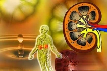 Tăng nguy cơ tử vong ung thư nếu suy thận mãn tính