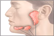 Các loại ung thư đầu cổ thường gặp (2)