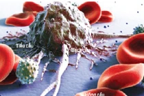 Phát hiện protein ngăn chặn di căn ung thư máu 