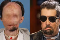 Những ca ghép mặt nổi tiếng trên thế giới