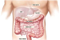  Gen gây ung thư phổi cũng gây ra ung thư đại tràng