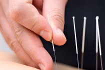 Tác dụng của châm cứu trong điều trị ung thư vú