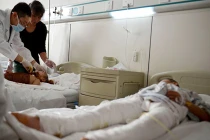 Bé 8 tuổi “đốt” hai em họ bắt chước phim hoạt hình