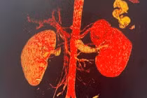 Quảng Bình: Cứu sống nam sinh bị đâm thủng thận “thập tử nhất sinh“