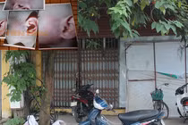 Bé 13 tháng tuổi bị cô giáo đánh tím mặt vì... nôn trong lớp