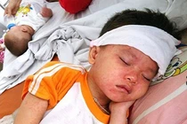 9 khuyến cáo nên đọc gấp để phòng chống bệnh sởi