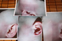 Cô giáo đánh bé 13 tháng tuổi tím mặt bị đuổi khỏi trường