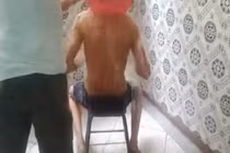 Chán dội nước đá, trai trẻ dội nước sôi lên người