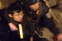 Vi phạm giao thông bị bắt, rồ ga đâm CSCĐ trọng thương