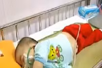 Bộ Y tế được, mất gì khi công bố dịch sởi?