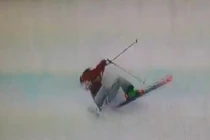 Vận động viên Olympic Sochi ngã gãy hàm