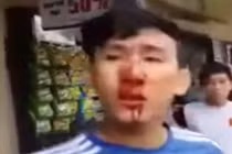 GĐ Công an chỉ đạo làm rõ vụ dân “tố” CSCĐ đánh người