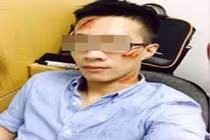 Trai trẻ hứng “gạch đá” vì đăng ảnh vết chém trên mặt