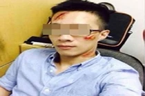 Trai trẻ hứng “gạch đá” vì đăng ảnh vết chém trên mặt