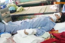 Chồng cắt gân tay, gân chân vợ: Nạn nhân đã tỉnh lại