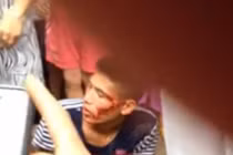 Dân vây đánh, hô đốt tên trộm xe máy