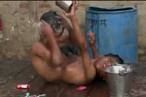 Cuộc sống của cặp song sinh dính liền nhau