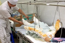 Nữ điều dưỡng bị bỏng ngực vì nướng mực ở bệnh viện