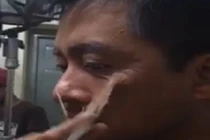 Tuấn Hưng lột da mặt một cách đáng sợ